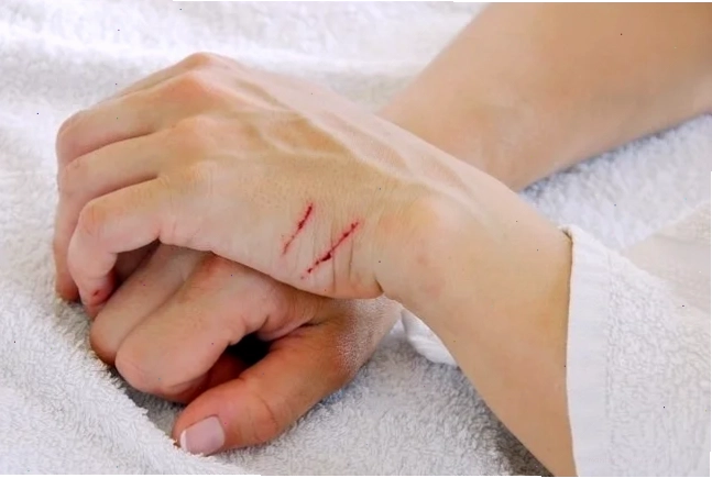 Hành vi tự hủy hoại bản thân ở phụ nữ để giải tỏa áp lực tâm lý